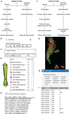 A New Pipeline to Automatically Segment and Semi-Automatically Measure Bone Length on 3D Models Obtained by Computed Tomography